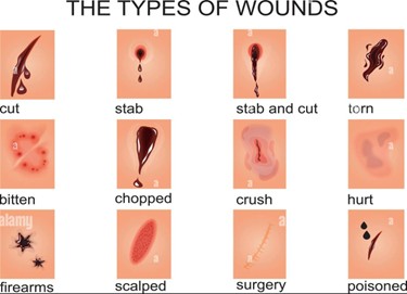 Understanding Wounds: Types, First Aid, and Proper Care
