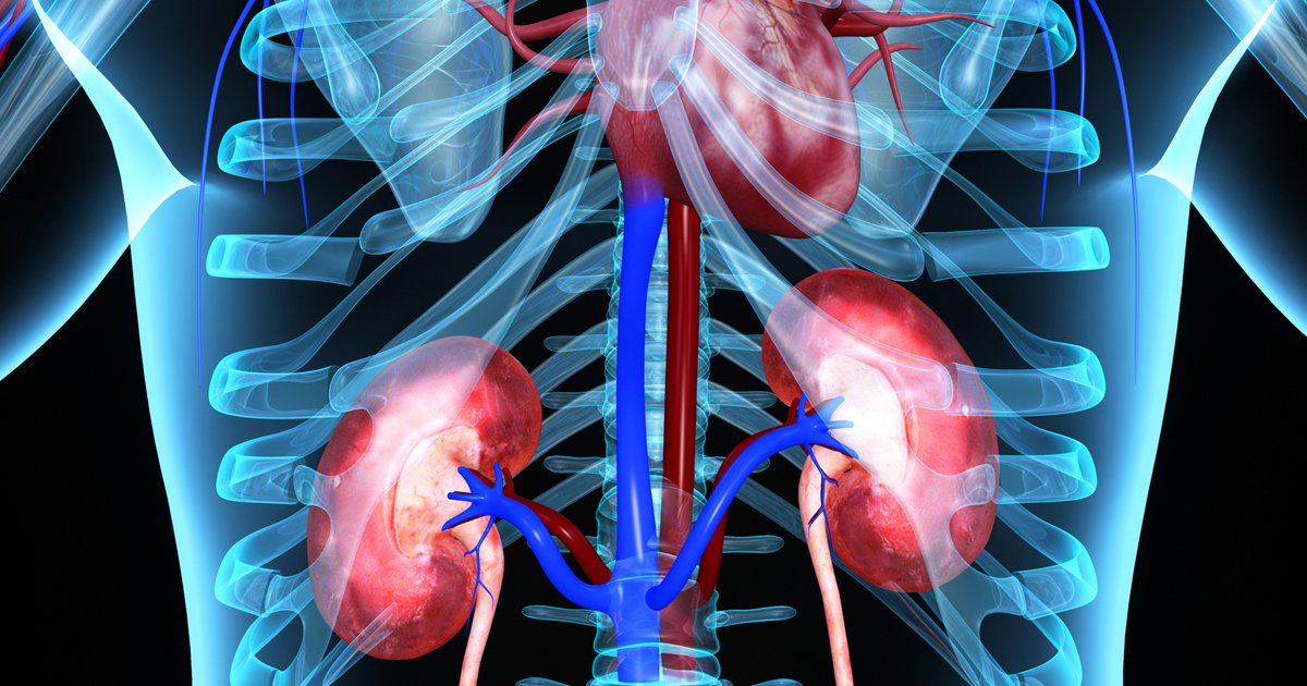 SHA dialysis coverage and kidney transplant explained