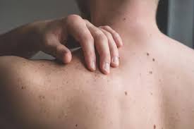 Cancer Warning Signs:Three Signals Your Body Should Never Ignore