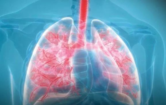 Kenya Respiratory Diseases Still Top Health Burden in 2025